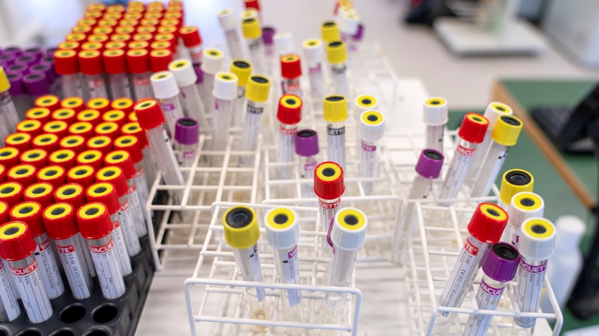 Regjeringen foreslår i statsbudsjettet å fjerne refusjonsordningen for laboratorieanalyser rekvirert av helprivate behandlere uten avtale med det offentlige.